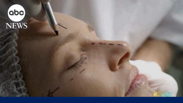 Behind the age-defying procedure dubbed the 'Forever-35' facelift